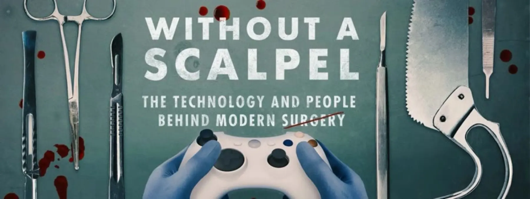 Without a Scalpel